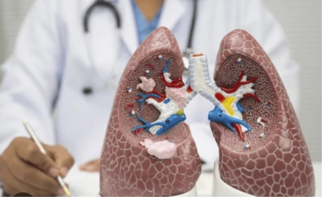 Costa Rica se posiciona como referente regional en trasplante pulmonar y alcanza récord histórico
